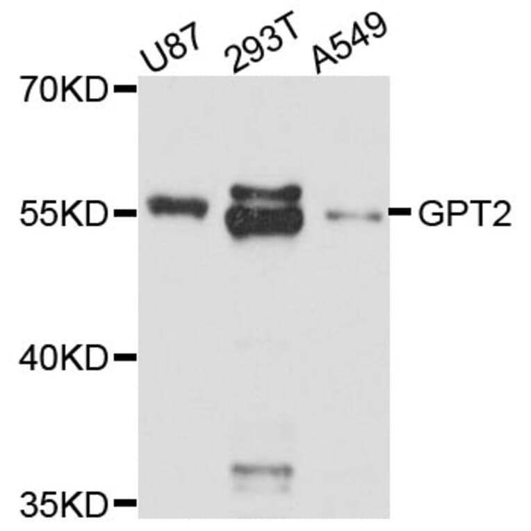 Western Blot - Anti-GPT2 Antibody (A11819) - Antibodies.com