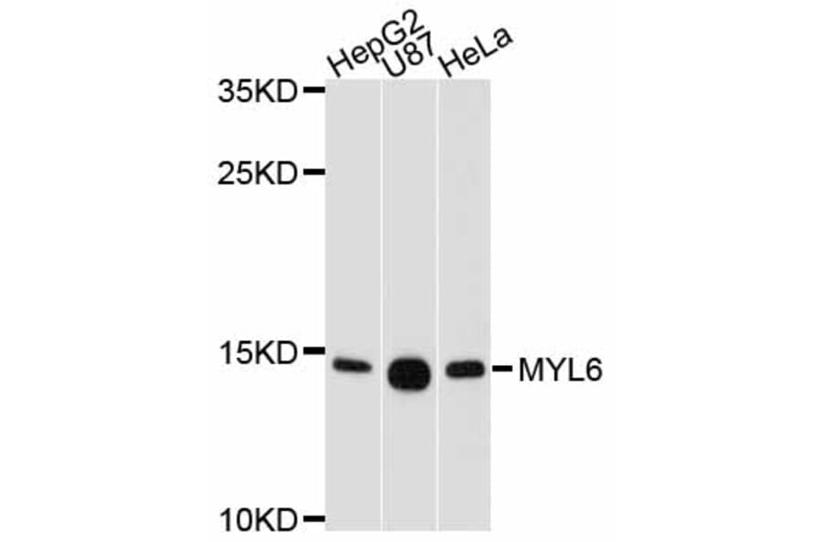 Western Blot - Anti-MYL6 Antibody (A11821) - Antibodies.com