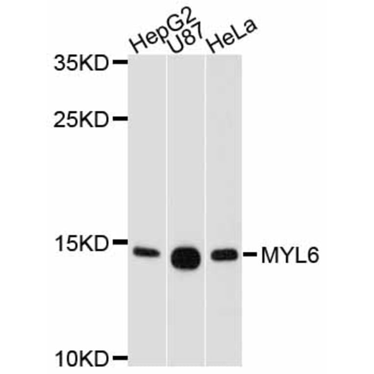 Western Blot - Anti-MYL6 Antibody (A11821) - Antibodies.com