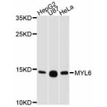 Western Blot - Anti-MYL6 Antibody (A11821) - Antibodies.com