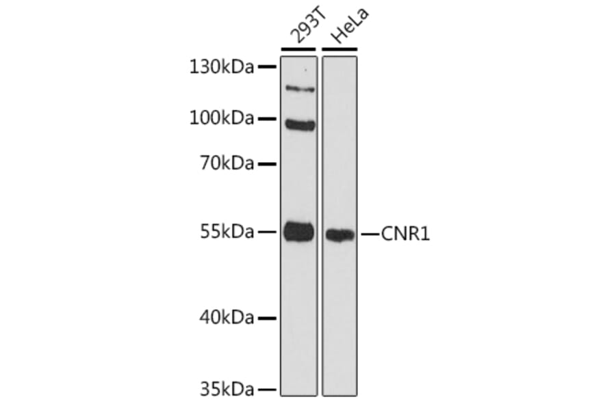 Western Blot - Anti-CNR1 Antibody (A11823) - Antibodies.com