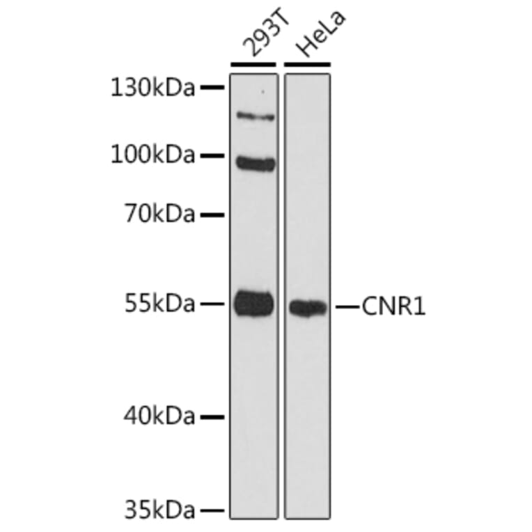 Western Blot - Anti-CNR1 Antibody (A11823) - Antibodies.com