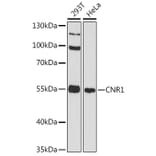 Western Blot - Anti-CNR1 Antibody (A11823) - Antibodies.com