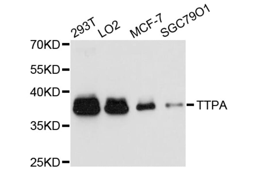 Western Blot - Anti-TTPA Antibody (A11825) - Antibodies.com