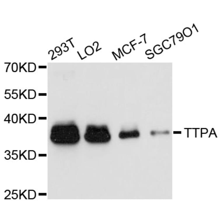 Western Blot - Anti-TTPA Antibody (A11825) - Antibodies.com
