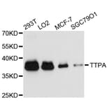 Western Blot - Anti-TTPA Antibody (A11825) - Antibodies.com