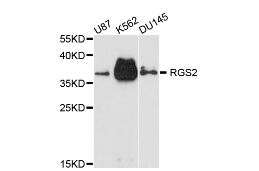 Western Blot - Anti-RGS2 Antibody (A11826) - Antibodies.com