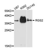 Western Blot - Anti-RGS2 Antibody (A11826) - Antibodies.com