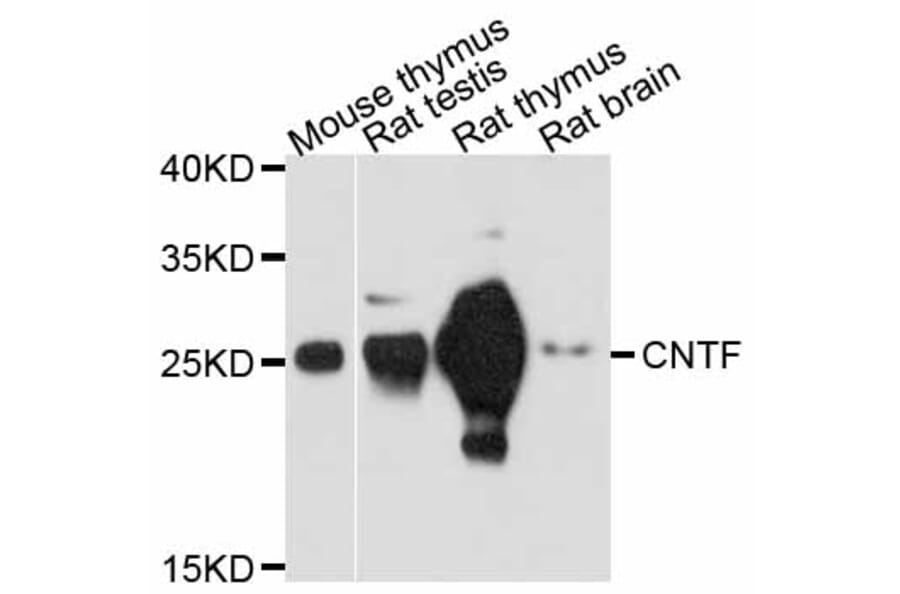 Western Blot - Anti-CNTF Antibody (A11827) - Antibodies.com