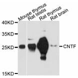 Western Blot - Anti-CNTF Antibody (A11827) - Antibodies.com