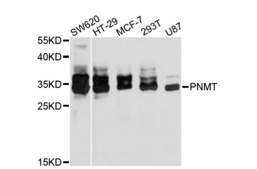 Western Blot - Anti-PNMT Antibody (A11833) - Antibodies.com