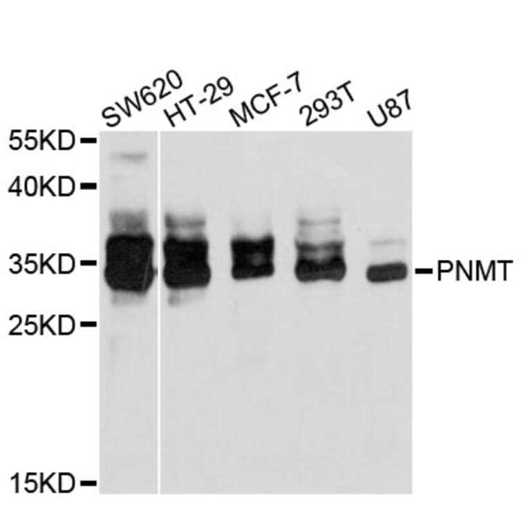 Western Blot - Anti-PNMT Antibody (A11833) - Antibodies.com