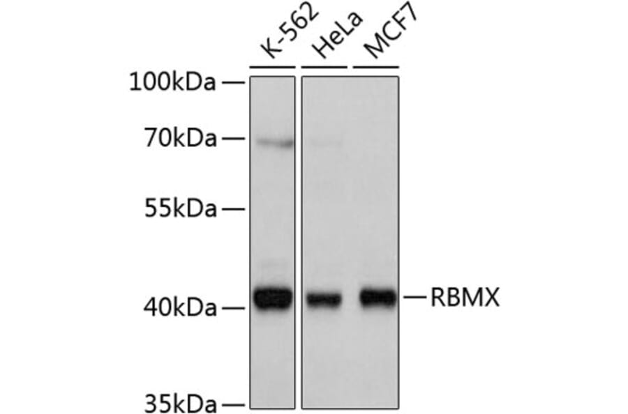 Western Blot - Anti-RBMX Antibody (A11834) - Antibodies.com