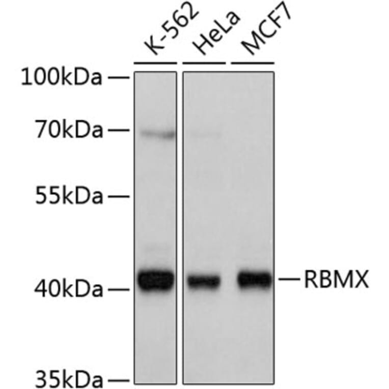 Western Blot - Anti-RBMX Antibody (A11834) - Antibodies.com