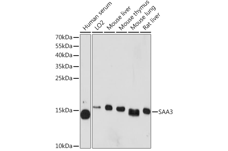 Western Blot - Anti-SAA3 Antibody (A81107) - Antibodies.com