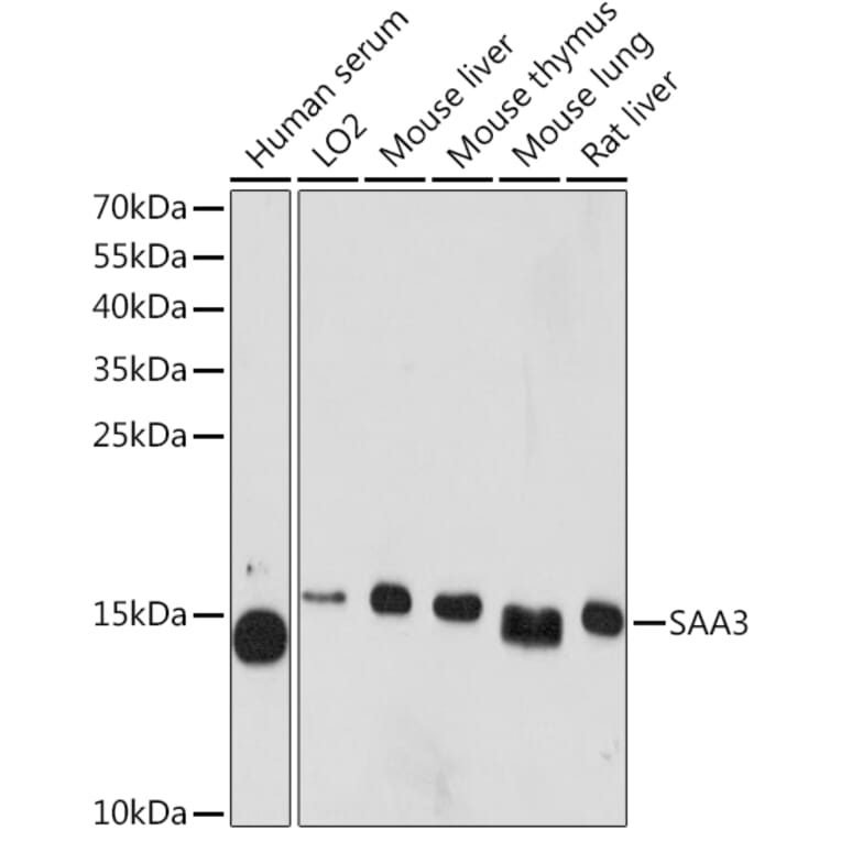 Western Blot - Anti-SAA3 Antibody (A81107) - Antibodies.com