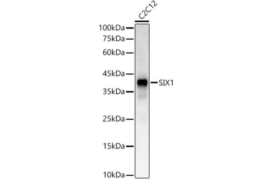 Western Blot - Anti-SIX1 Antibody (A81108) - Antibodies.com