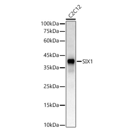 Western Blot - Anti-SIX1 Antibody (A81108) - Antibodies.com