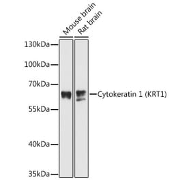 Western Blot - Anti-Cytokeratin 1 Antibody (A81110) - Antibodies.com