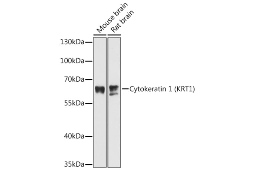 Western Blot - Anti-Cytokeratin 1 Antibody (A81110) - Antibodies.com