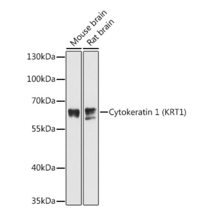 Western Blot - Anti-Cytokeratin 1 Antibody (A81110) - Antibodies.com