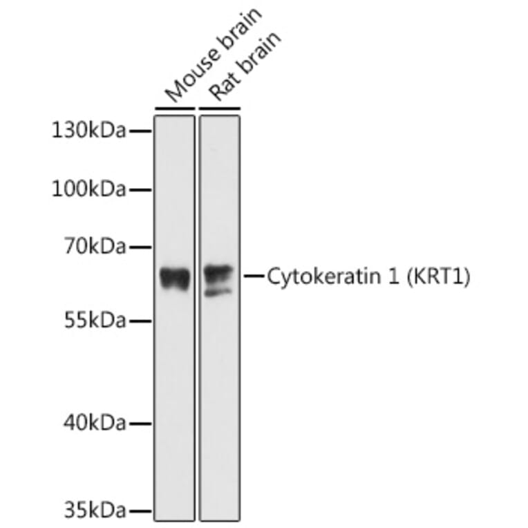 Western Blot - Anti-Cytokeratin 1 Antibody (A81110) - Antibodies.com