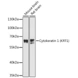 Western Blot - Anti-Cytokeratin 1 Antibody (A81110) - Antibodies.com