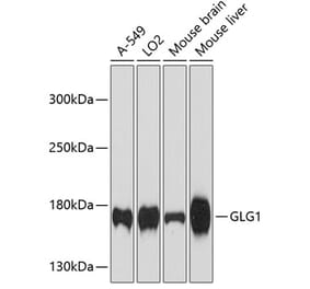 Western Blot - Anti-Golgi Complex Antibody (A81111) - Antibodies.com