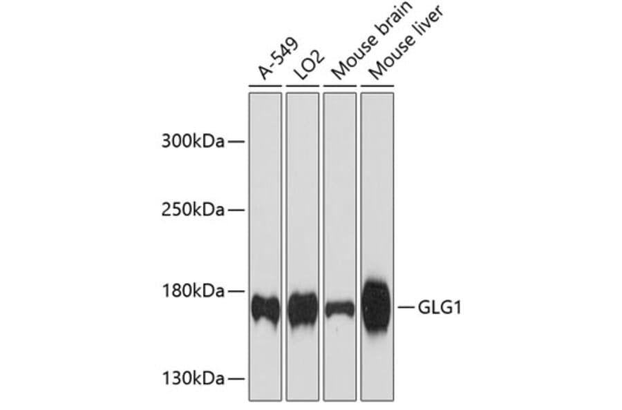 Western Blot - Anti-Golgi Complex Antibody (A81111) - Antibodies.com