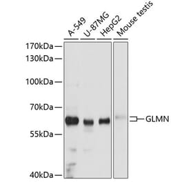 Western Blot - Anti-GLMN Antibody (A81112) - Antibodies.com