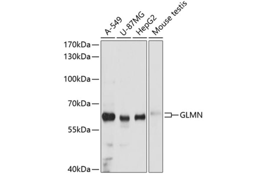 Western Blot - Anti-GLMN Antibody (A81112) - Antibodies.com
