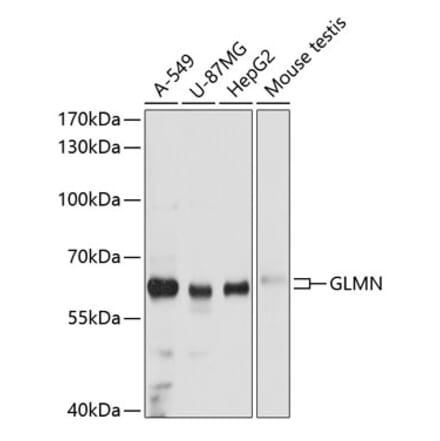 Western Blot - Anti-GLMN Antibody (A81112) - Antibodies.com