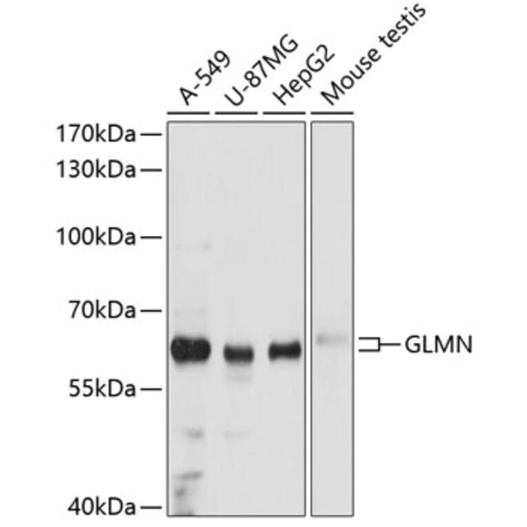 Western Blot - Anti-GLMN Antibody (A81112) - Antibodies.com