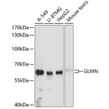 Western Blot - Anti-GLMN Antibody (A81112) - Antibodies.com