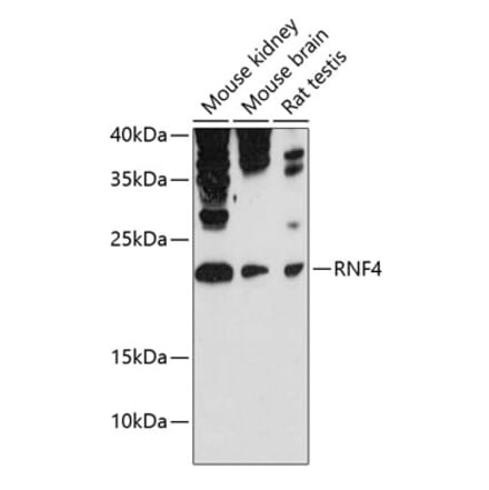 Western Blot - Anti-RNF4 Antibody (A81113) - Antibodies.com