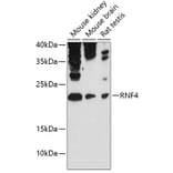 Western Blot - Anti-RNF4 Antibody (A81113) - Antibodies.com