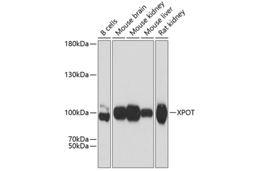 Western Blot - Anti-XPOT Antibody (A81114) - Antibodies.com