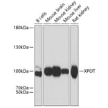 Western Blot - Anti-XPOT Antibody (A81114) - Antibodies.com