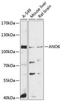 Western blot analysis of extracts of various cell lines, using Anti-ANO6 Antibody (A12050) at 1:3000 dilution.
Secondary antibody: Goat Anti-Rabbit IgG (H+L) (HRP) (AS014) at 1:10,000 dilution.
Lysates / proteins: 25µg per lane.
Blocking buffer: 3% non-fat dry milk in TBST.
Detection: ECL Basic Kit (RM00020).
Exposure time: 90s.