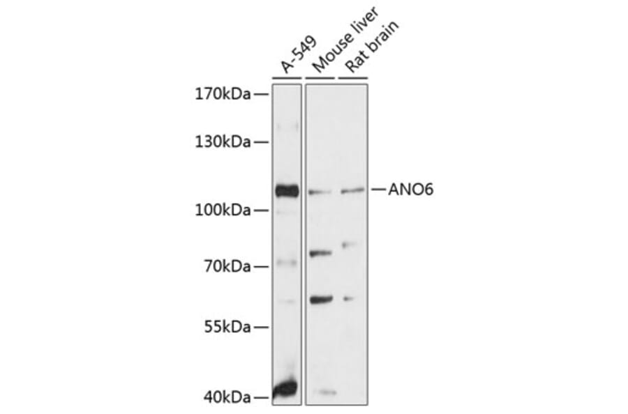 Western Blot - Anti-ANO6 Antibody (A81115) - Antibodies.com