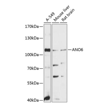 Western Blot - Anti-ANO6 Antibody (A81115) - Antibodies.com