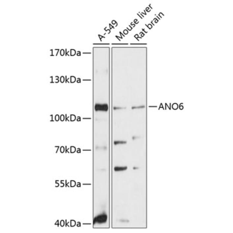 Western Blot - Anti-ANO6 Antibody (A81115) - Antibodies.com