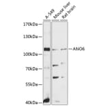 Western Blot - Anti-ANO6 Antibody (A81115) - Antibodies.com