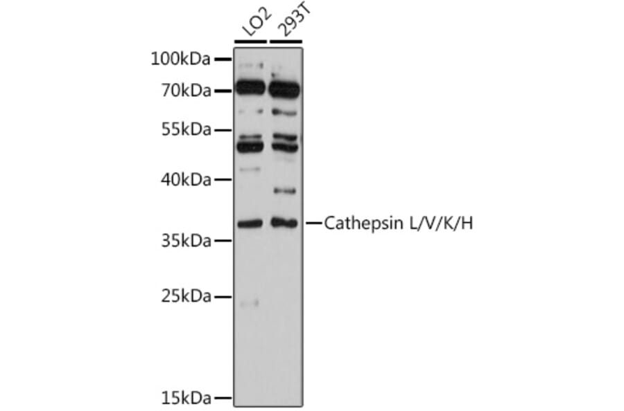 Western Blot - Anti-Cathepsin L/MEP Antibody (A81116) - Antibodies.com