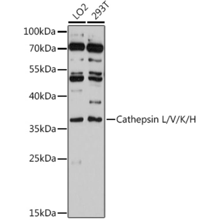Western Blot - Anti-Cathepsin L/MEP Antibody (A81116) - Antibodies.com