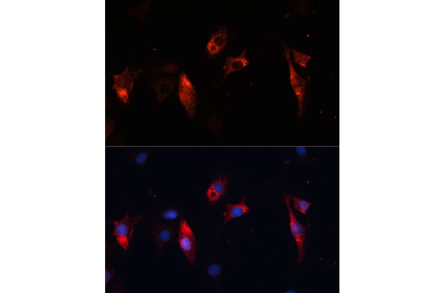 Immunofluorescence - Anti-Cathepsin L/MEP Antibody (A81116) - Antibodies.com