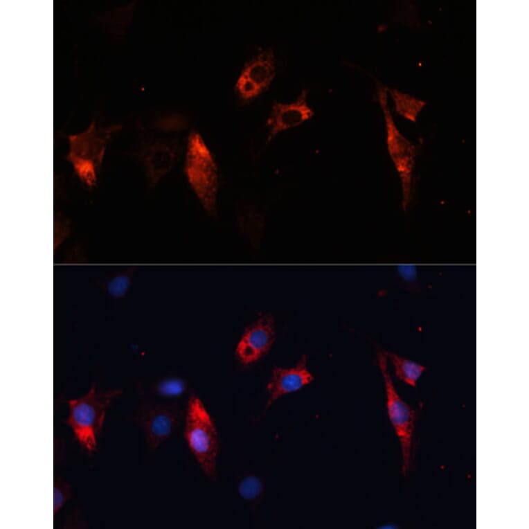 Immunofluorescence - Anti-Cathepsin L/MEP Antibody (A81116) - Antibodies.com