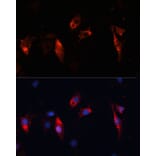 Immunofluorescence - Anti-Cathepsin L/MEP Antibody (A81116) - Antibodies.com