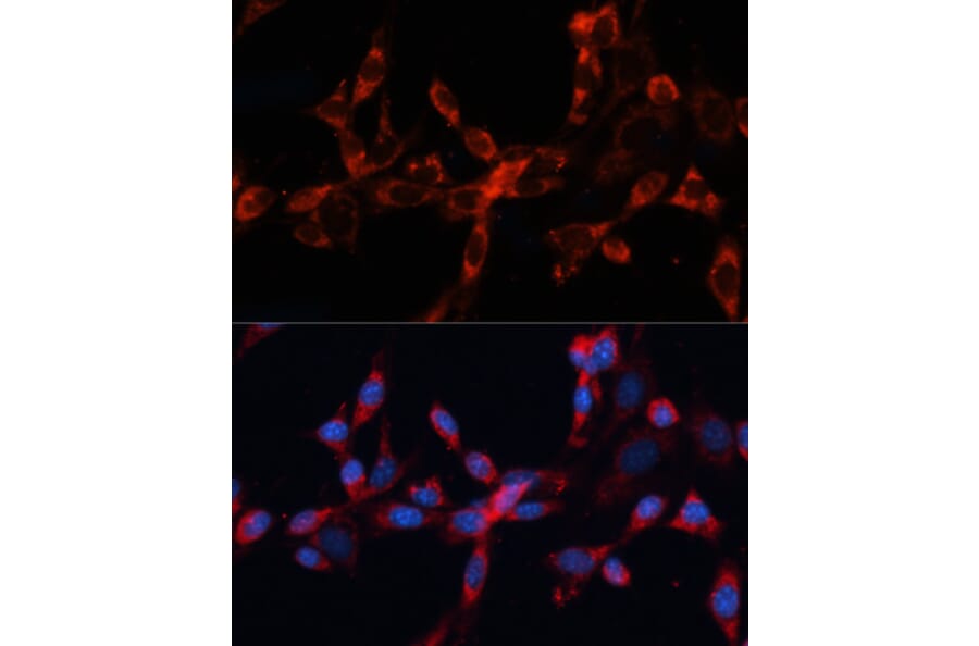 Immunofluorescence - Anti-Cathepsin L/MEP Antibody (A81116) - Antibodies.com