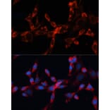 Immunofluorescence - Anti-Cathepsin L/MEP Antibody (A81116) - Antibodies.com